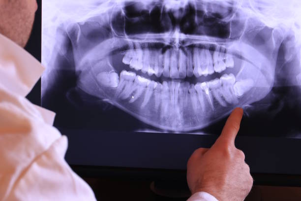 Best Emergency Treatment for Dental Infections or Abscesses in New Vienna, OH