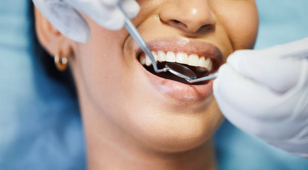Best Emergency Treatment for Dental Infections or Abscesses in New Vienna, OH