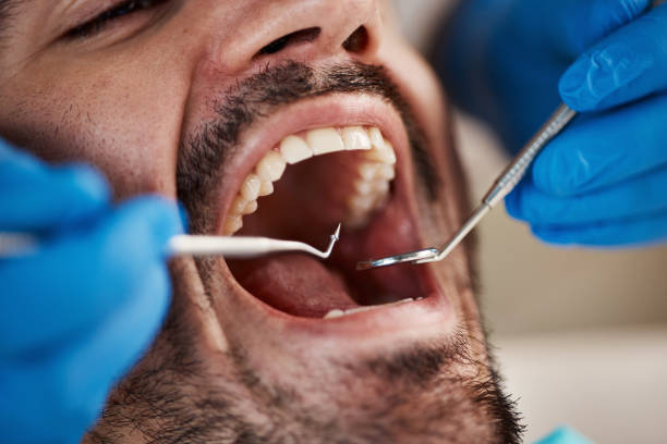 Best Pediatric Emergency Dentist in New Vienna, OH