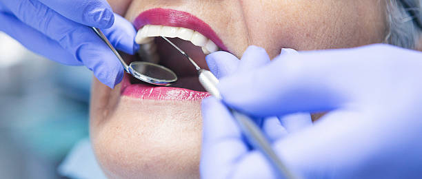 Best Emergency Wisdom Teeth Removal in New Vienna, OH